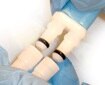 NeoSnap accessory close-up