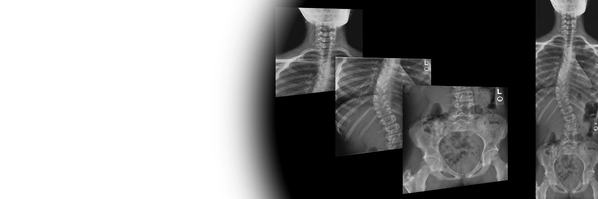 Auto Image Paste Ge Healthcare