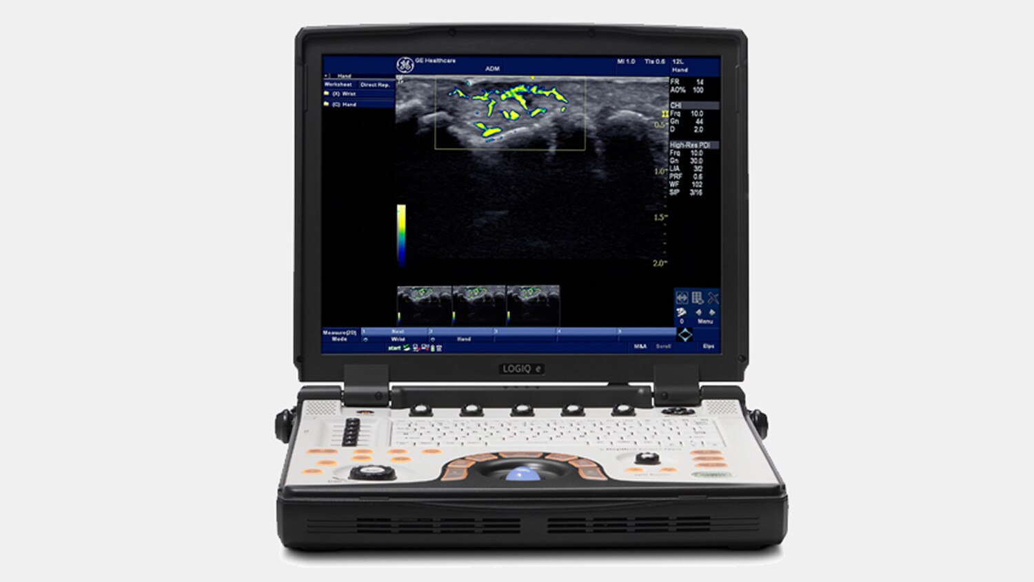 duct-categories-ultrasound-point-of-care-new-logiq-e-ultrasound-thumbnail-image_080615.jpg