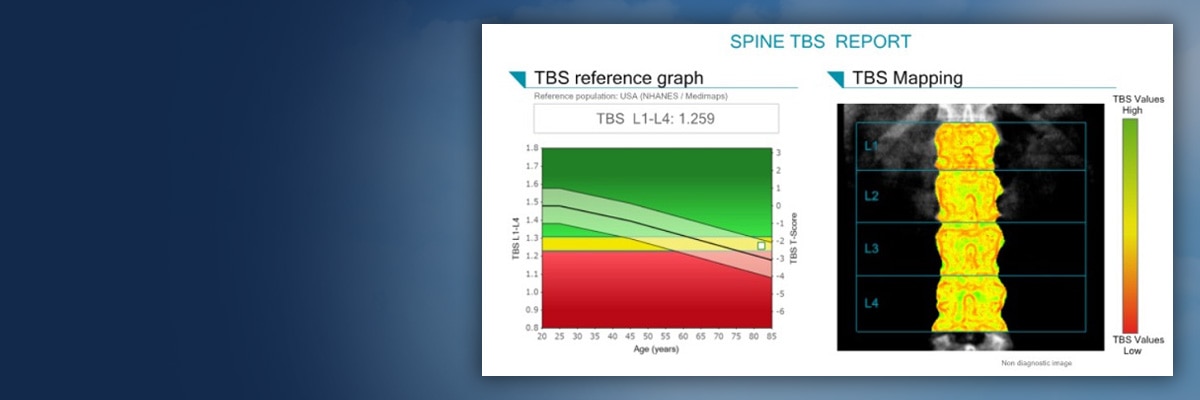 Trabecular Bone Score | GE HealthCare (Australia & New Zealand)