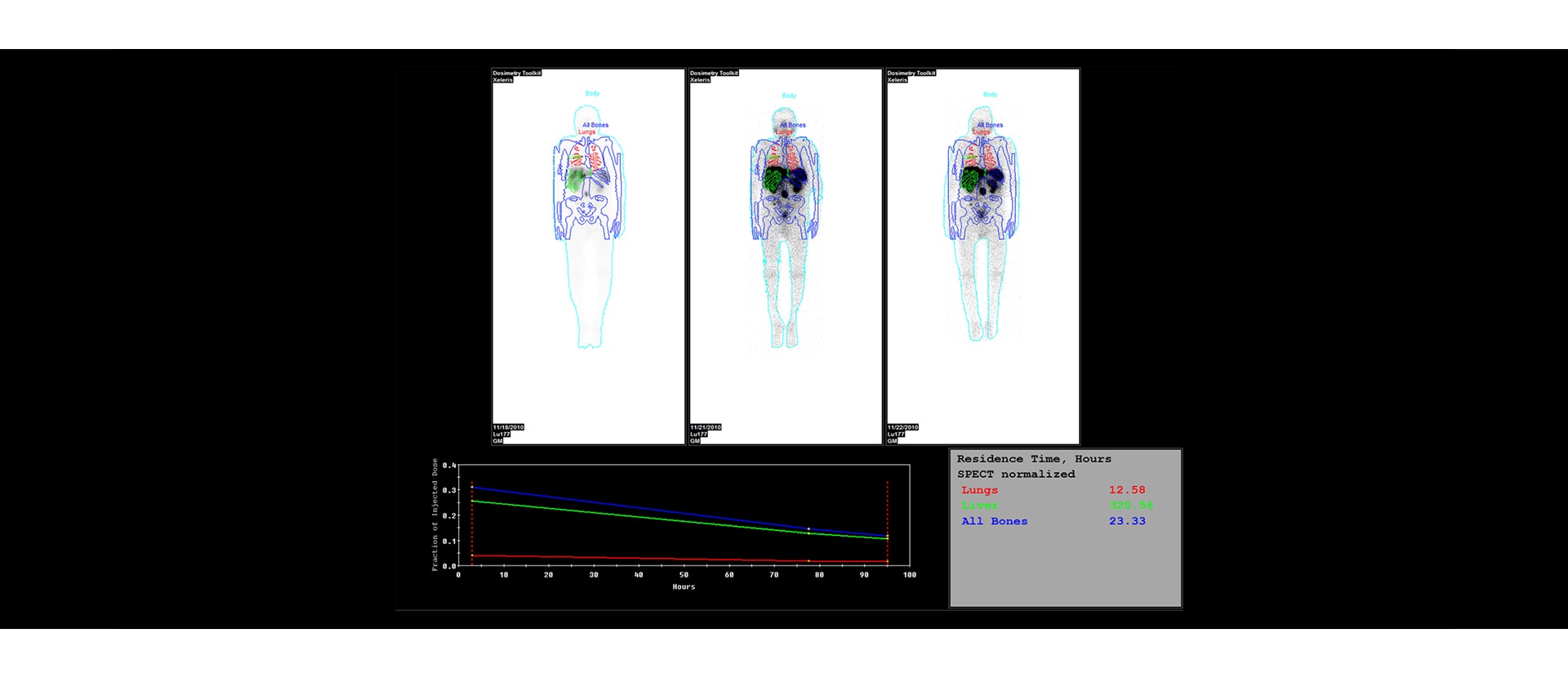 GEHC Xeleris 4 DR Dosimetry Toolkit Image 1 v1