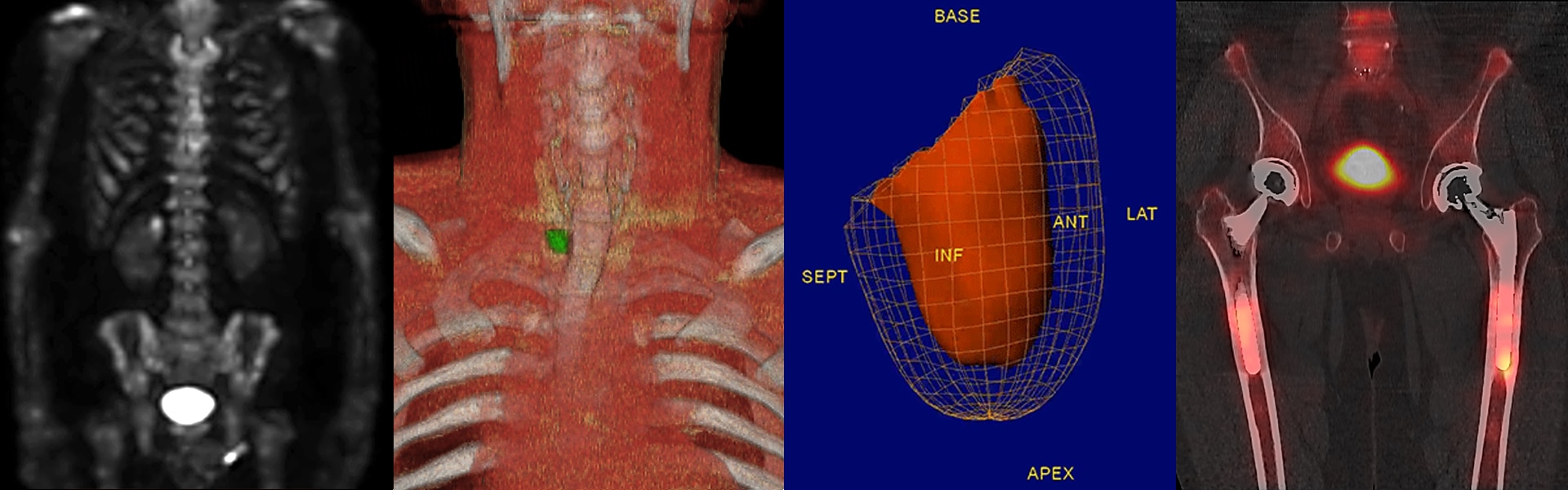 StarGuide | SPECT/CT | GE Healthcare ANZ | GE HealthCare (Australia ...