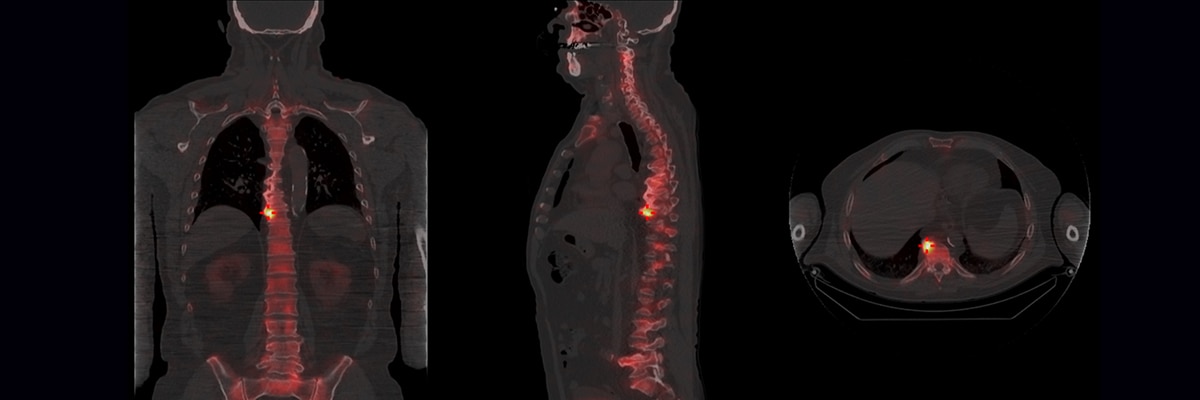 StarGuide | SPECT/CT | GE Healthcare ANZ | GE HealthCare (Australia ...