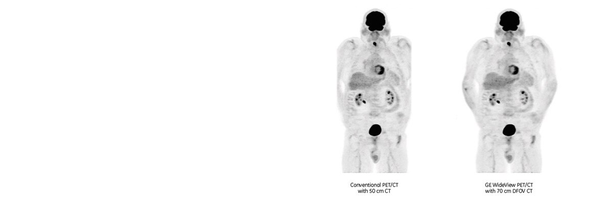 WideView | GE HealthCare (Australia & New Zealand)