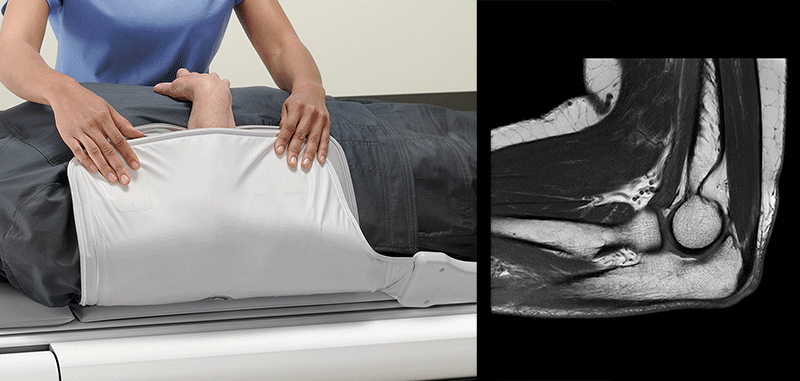 Get closer with adaptive MR